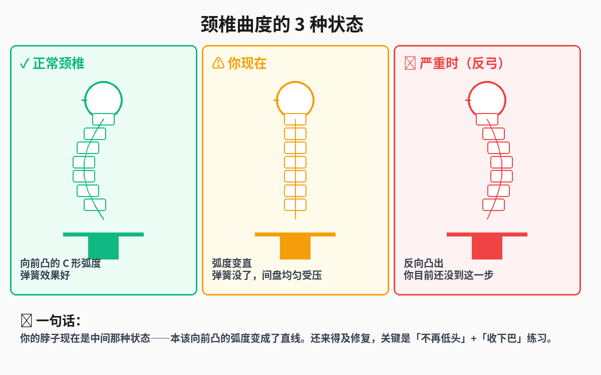 颈椎三种状态